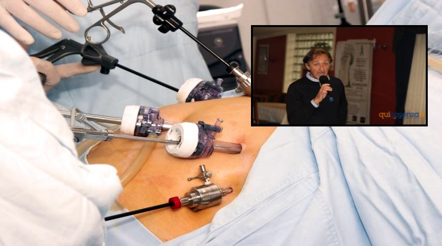 chirurgia bariatrica