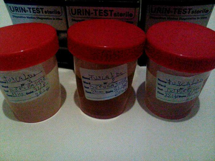 prelievi acqua fuscaldo