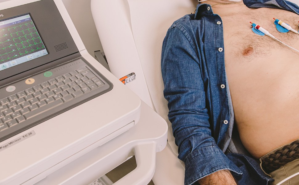 ecg elettro cardiogramma