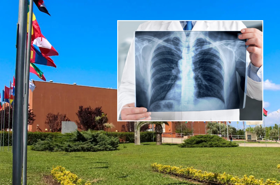 Unical prof chirurgia toracica