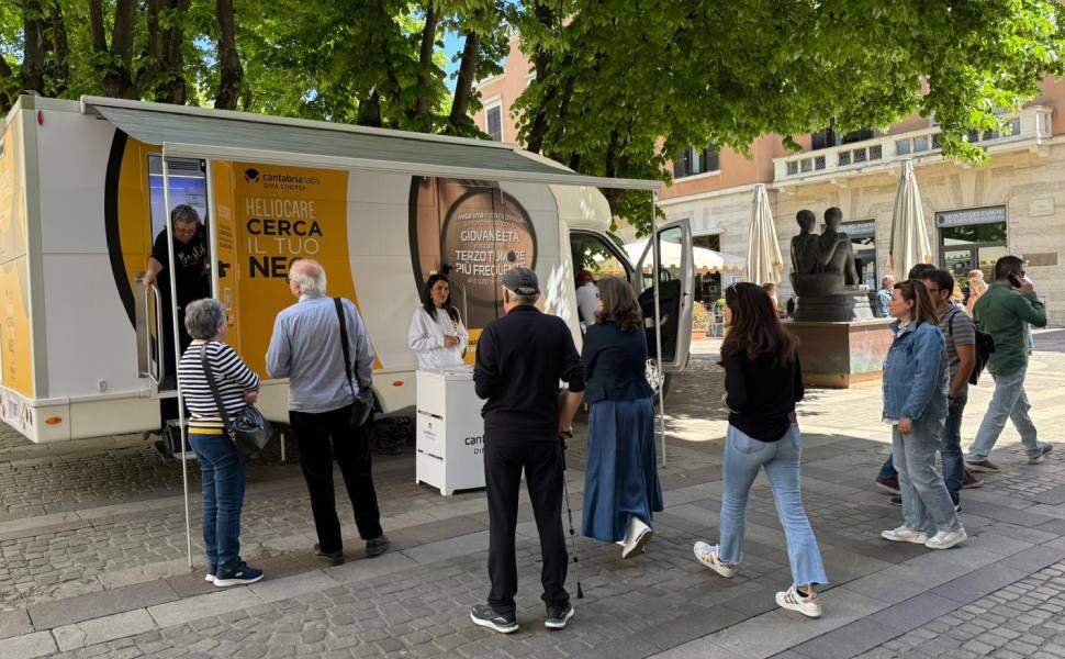 melanoma screening cosenza