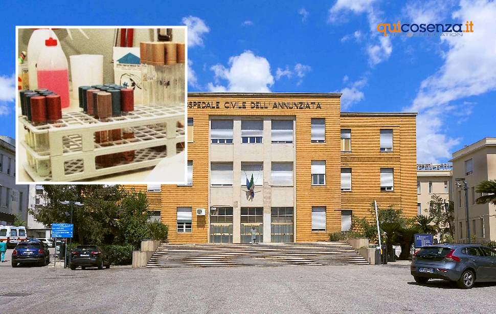Ospedale-Civile-dellAnnunziata-Cosenza siero botulino