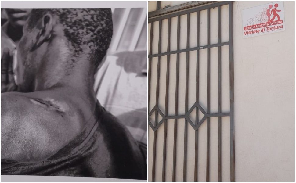 Cosenza ambulatorio migranti sopravvissuti tortura