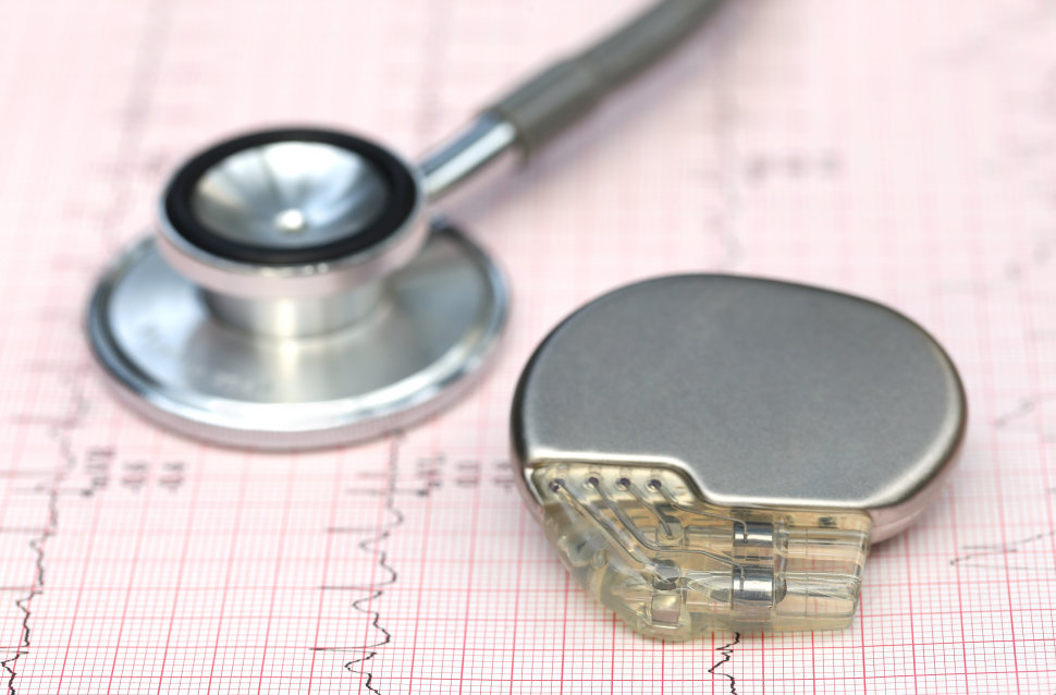 Pacemaker senza fili Asp Cosenza