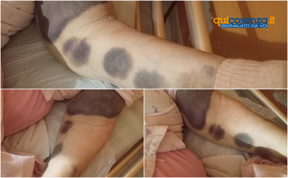 denuncia rita palumbo